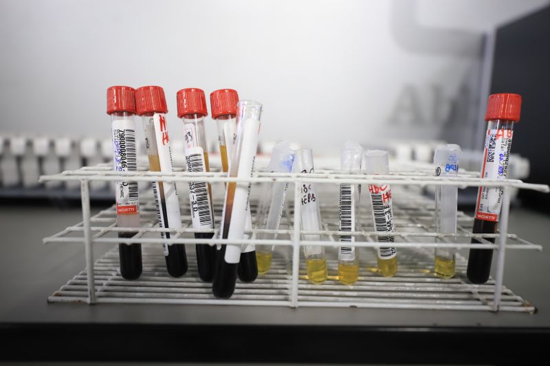  <div class='credito_fotos'>Foto: Bruno Cruz / Ag. Pará &nbsp;&nbsp;|&nbsp;&nbsp; <a href='/midias/2024/originais/18456_5dbda9c3-7bb6-650c-8add-651ca4614d89.jpg' download><i class='fa-solid fa-download'></i> Download</a></div>