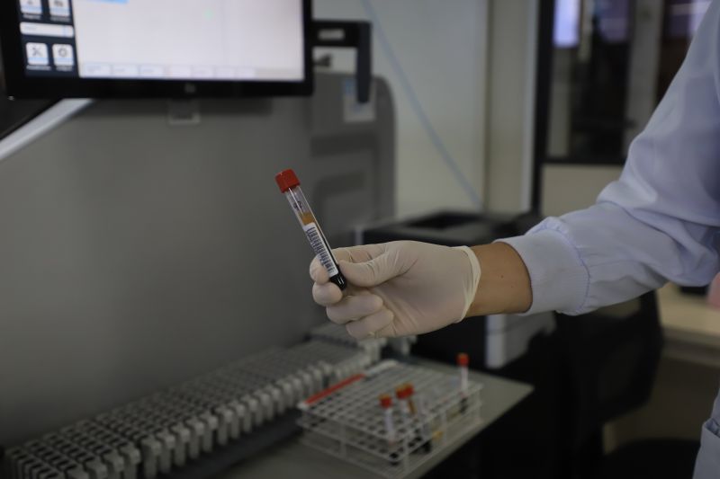  <div class='credito_fotos'>Foto: Bruno Cruz / Ag. Pará &nbsp;&nbsp;|&nbsp;&nbsp; <a href='/midias/2024/originais/18456_a47a05b2-84f1-77c1-7f57-f9a4611e0098.jpg' download><i class='fa-solid fa-download'></i> Download</a></div>