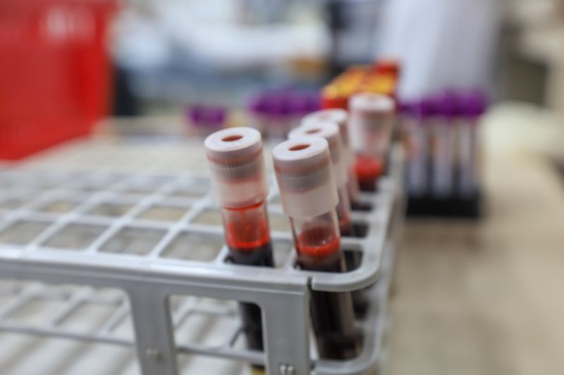  <div class='credito_fotos'>Foto: Bruno Cruz / Ag. Pará &nbsp;&nbsp;|&nbsp;&nbsp; <a href='/midias/2024/originais/19985_75e255e1-4033-92ad-bbee-44cee43c37ba.jpg' download><i class='fa-solid fa-download'></i> Download</a></div>