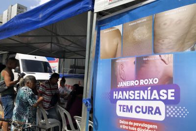 notícia: Estado realiza o Dia D de combate à hanseníase em Belém