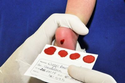 notícia: Secretaria de Saúde do Pará (Sespa) destaca importância do Teste do Pezinho 