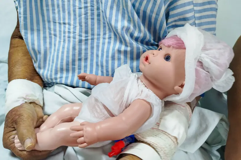 A boneca é utilizada como recurso terapeutico