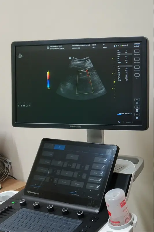 Aparelho de ultrassonografia da unidade