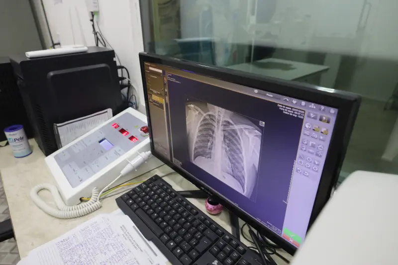  <div class='credito_fotos'>Foto: Pedro Guerreiro / Ag. Pará &nbsp;&nbsp;|&nbsp;&nbsp; <a href='/midias/2025/originais/20250722173155-GF00024270-F00424876.jpg' download><i class='fa-solid fa-download'></i> Download</a></div>