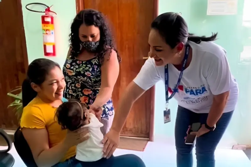 notícia: Pará é referência nacional no atendimento a pacientes com fissuras labiopalatais