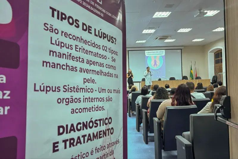 notícia: Santa Casa realiza II Simpósio de Lúpus em parceria com a associação paraense de portadores da doença 